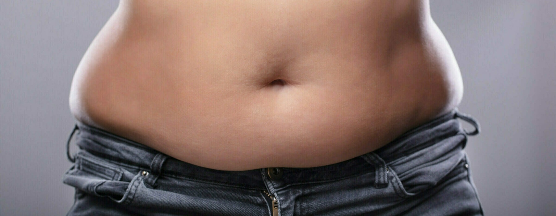 Mid,Section,Of,A,Woman,With,Excessive,Belly,Fat,Against